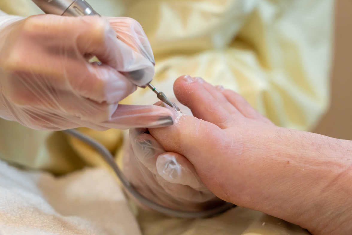 The Essential Role of Foot Care Nursing Unlocking the Benefits for